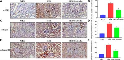 Gastrodin attenuates renal injury and collagen deposition via suppression of the TGF-β1/Smad2/3 signaling pathway based on network pharmacology analysis